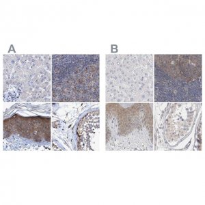 Anti-BICD2 antibody produced in rabbit 