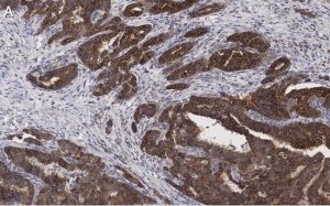 Anti-BIM Antibody, clone 2O18, ZooMAb Rabbit Monoclonal 
