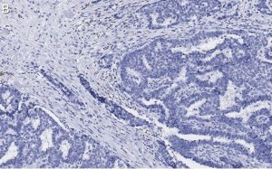 Anti-BIM Antibody, clone 2O18, ZooMAb Rabbit Monoclonal 