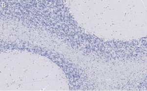 Anti-Bin1 Antibody, clone 99D.2 ZooMAb Mouse Monoclonal 