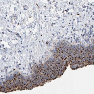 Anti-BIN3 antibody produced in rabbit HPA023769-100UL