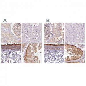 Anti-BLMH antibody produced in rabbit 