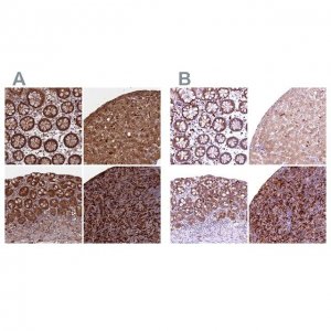 Anti-BLVRB antibody produced in rabbit 