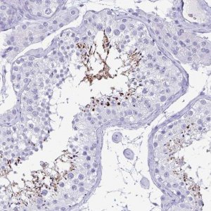 Anti-BPIFA3 antibody produced in rabbit 