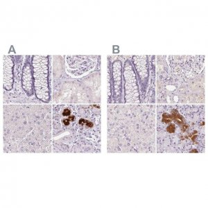 Anti-BPIFB2 antibody produced in rabbit 