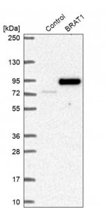 Anti-BRAT1 antibody produced in rabbit 