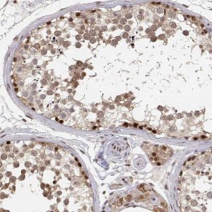 Anti-BRCA1 