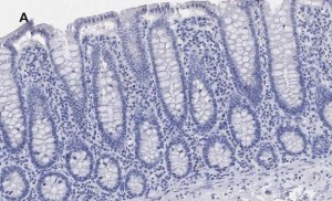 Anti-BRG1 Antibody, clone 1N12, ZooMAb Rabbit Monoclonal 