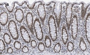 Anti-BRG1 Antibody, clone 1N12, ZooMAb Rabbit Monoclonal 