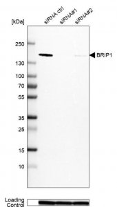 Anti-BRIP1 antibody produced in rabbit 