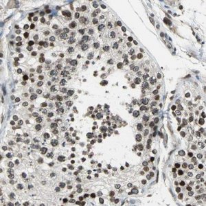 Anti-BRIP1 antibody produced in rabbit 