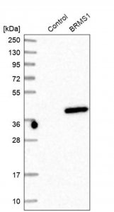 Anti-BRMS1 antibody produced in rabbit HPA019637-100UL