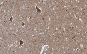 Anti-BSN Antibody, clone 2I2 ZooMAb Rabbit Monoclonal 