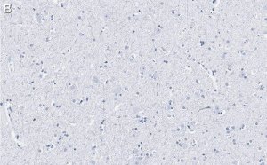 Anti-BSN Antibody, clone 2I2 ZooMAb Rabbit Monoclonal 