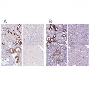 Anti-BSND antibody produced in rabbit 