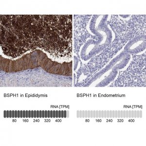 Anti-BSPH1 