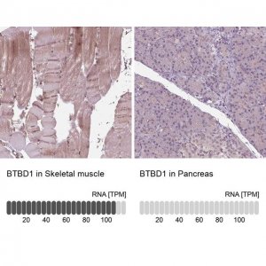Anti-BTBD1 antibody produced in rabbit 
