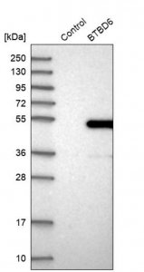 Anti-BTBD6 antibody produced in rabbit HPA031355-100UL