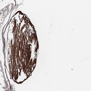 Anti-BTBD6 antibody produced in rabbit HPA031355-100UL