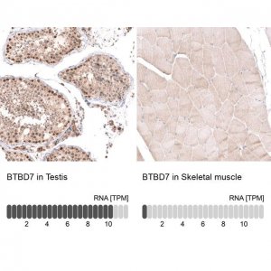 Anti-BTBD7 antibody produced in rabbit 