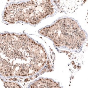 Anti-BTBD7 antibody produced in rabbit 