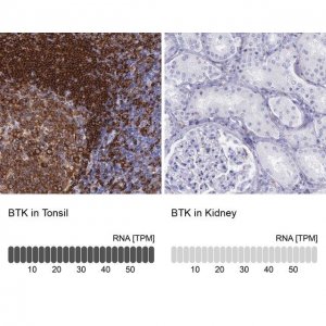 Anti-BTK antibody produced in rabbit 
