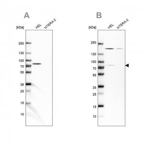 Anti-BTK antibody produced in rabbit 