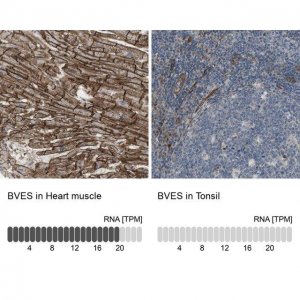 Anti-BVES antibody produced in rabbit 