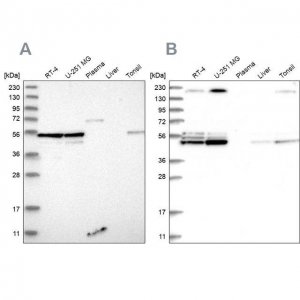 Anti-BYSL antibody produced in rabbit 