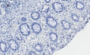 Anti-C-EBP beta Antibody, clone 8G18, ZooMAb Rabbit Monoclonal 