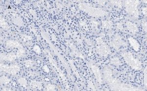 Anti-c-Myc Antibody, clone 7E18, ZooMAb Rabbit Monoclonal 