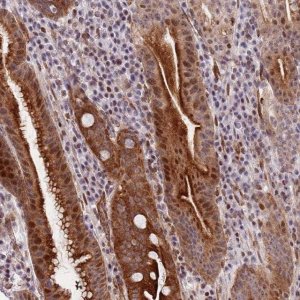 Anti-C10ORF11 antibody produced in rabbit 