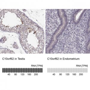Anti-C10orf62 antibody produced in rabbit 