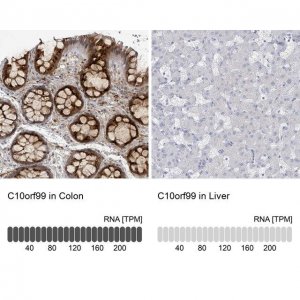 Anti-C10ORF99 antibody produced in rabbit 