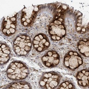 Anti-C10ORF99 antibody produced in rabbit 