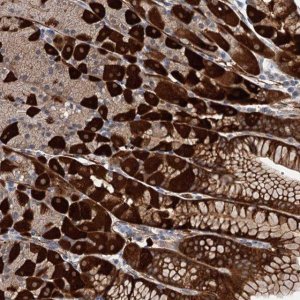 Anti-C11orf49 antibody produced in rabbit 