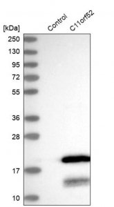 Anti-C11orf52 antibody produced in rabbit 