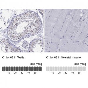Anti-C11orf63 
