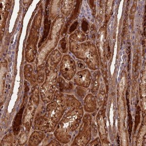 Anti-C16orf70 antibody produced in rabbit 