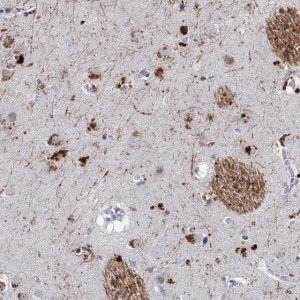 Anti-C16orf72 antibody produced in rabbit HPA041568-100UL