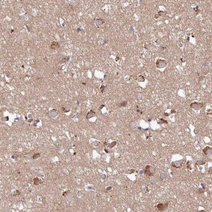 Anti-C17ORF51 antibody produced in rabbit 