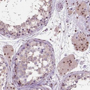 Anti-C1orf112 antibody produced in rabbit 