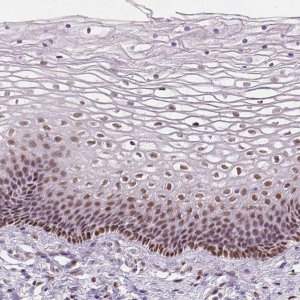 Anti-C1orf112 antibody produced in rabbit 