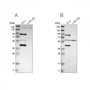 Anti-C1orf116 antibody produced in rabbit HPA011889-100UL