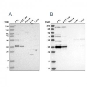 Anti-C1orf131 antibody produced in rabbit 