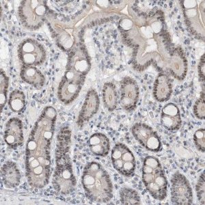 Anti-C1orf131 antibody produced in rabbit 
