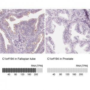 Anti-C1orf194 antibody produced in rabbit 