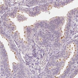 Anti-C1orf194 antibody produced in rabbit 