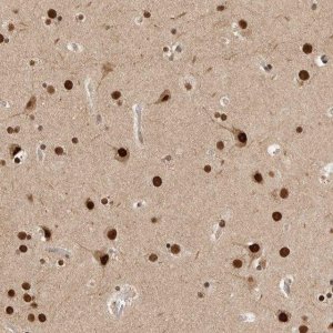 Anti-C1orf21 antibody produced in rabbit 