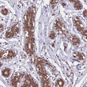 Anti-C1orf35 antibody produced in rabbit 